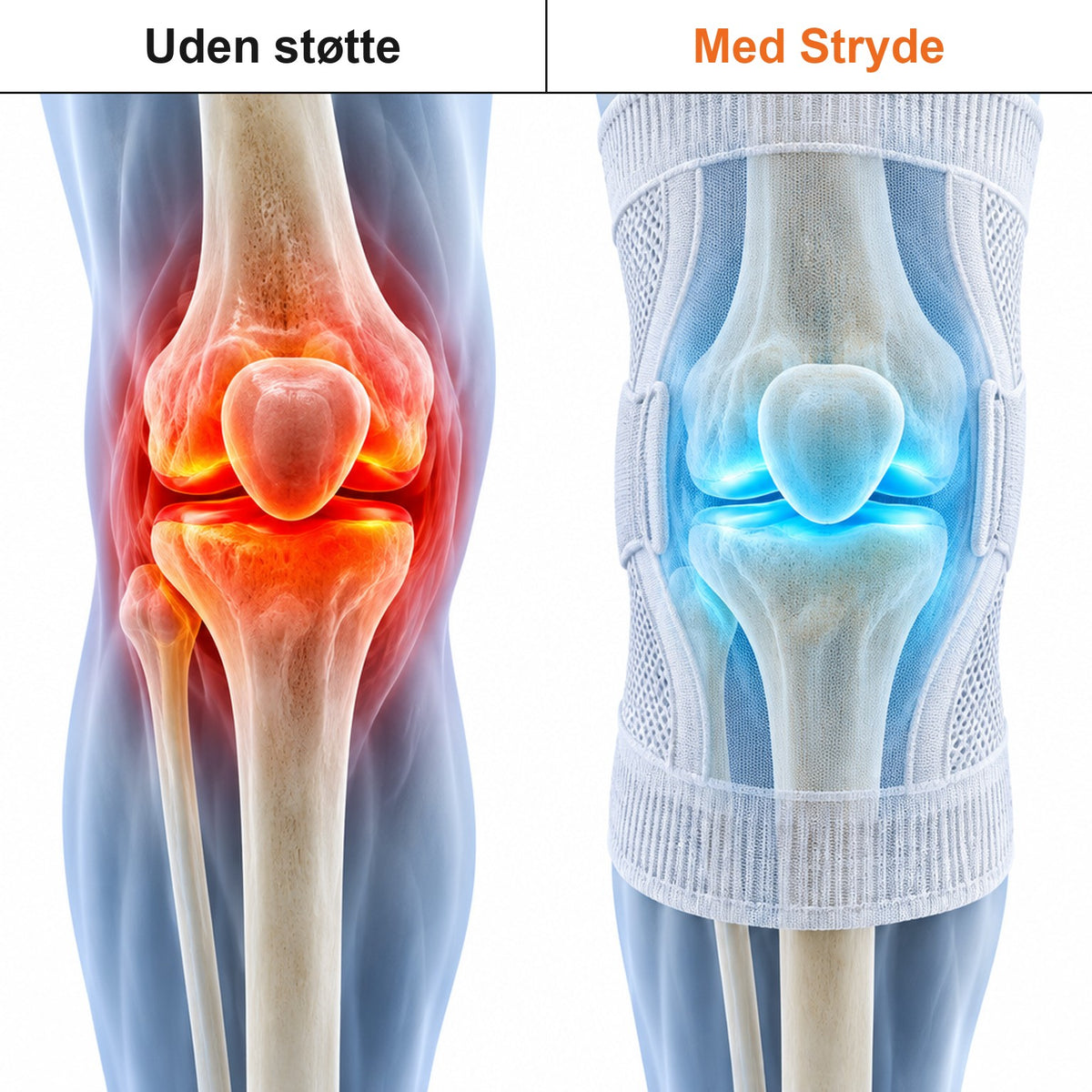 Knæet uden og med støtte